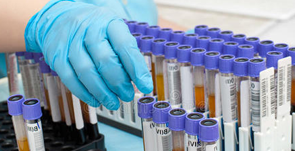 1604296600899582.png 4.png