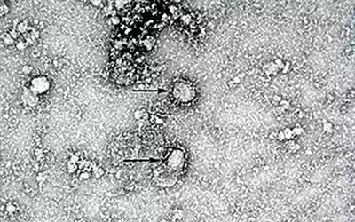 各種規格重組干擾素