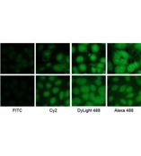 Jackson公司優質二抗